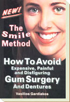 The Smile Method Book How to Avoide Gum Surgery